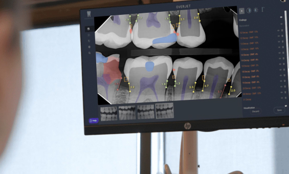 나만의 치과 주치의, 덴탈 AI